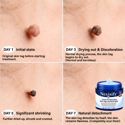Nexisify® Advanced Correcting Cream